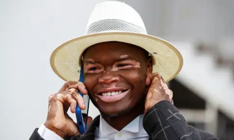 MONICAH MWANGI / REUTERS A smiling man wearing a sun hat speaks on the phone. He has the skin condition vitiligo.