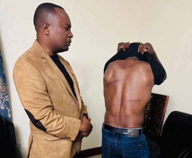 Kabambe Visits Wounded Activist, Condemns “Barbaric” Attack as Threat to Democracy