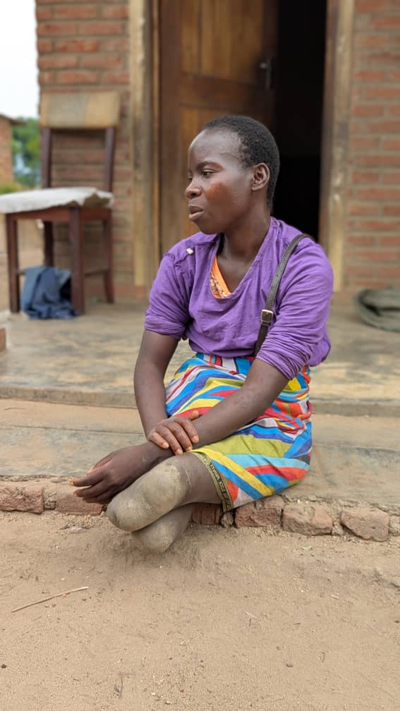 CCYCDO Strengthens Community Ties Through Visit to Disabled Individuals in Chiradzulu img 20260304 wa0184